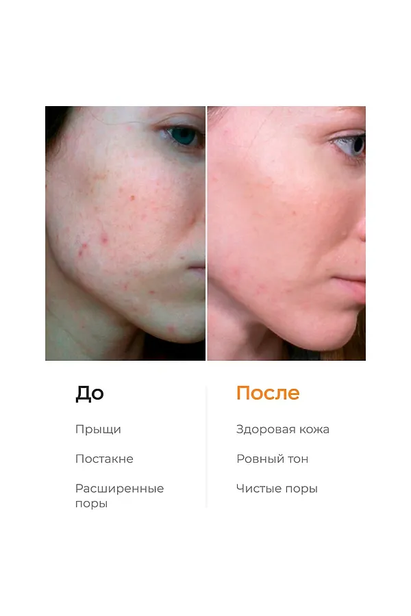 Likato Энзимная пудра для очищения чувствительной кожи и осветления следов постакне, 150 мл KRISTALLER, витамин c - фото 2