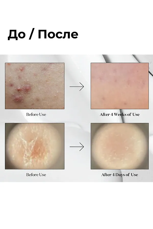 VT Cosmetics Бустер-сыворотка для лица с микроиглами и экстрактом центеллы азиатской / Reedle Shot 100, 50 мл KRISTALLER, серебристый - фото 2