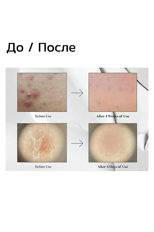 VT Cosmetics Мягкая бустер-сыворотка с микроиглами для гладкой и сияющей кожи / Midl Reedle Shot 50, 50 мл KRISTALLER, белый - фото 2