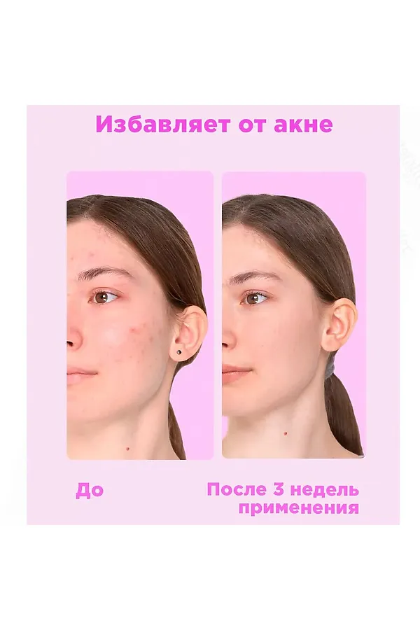 Likato Тоник с фруктовыми кислотами AHA 7%, 150 мл KRISTALLER, - - фото 2